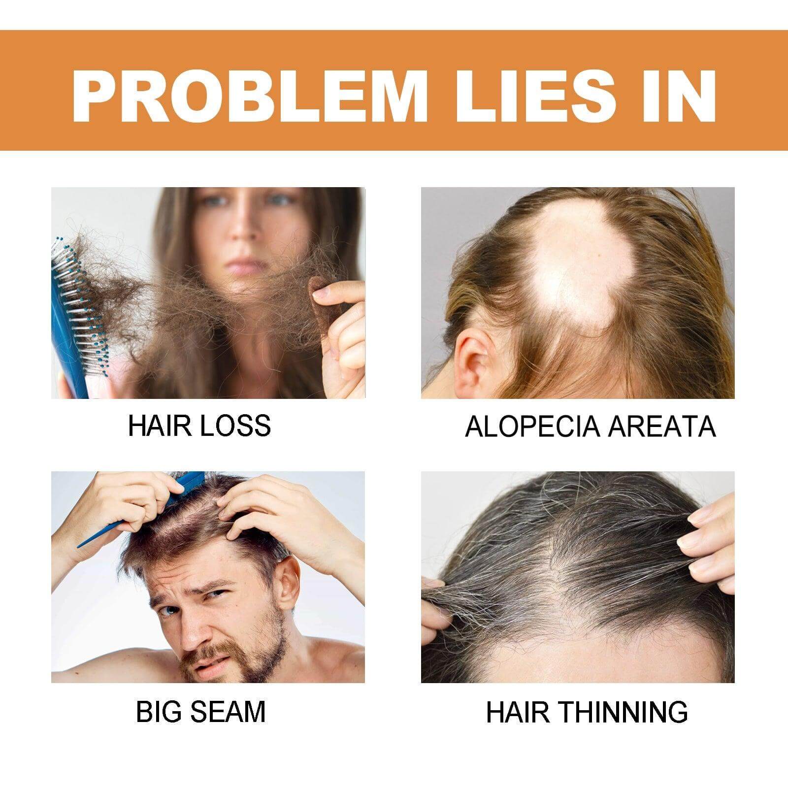 Mypa Ampoule, Strengthen And Repair Hair, Prevent Hair Loss, Strengthen Hair Root And Thicken Hair And Scalp Massage Solution - CLAUALIS HAIR COUTURE